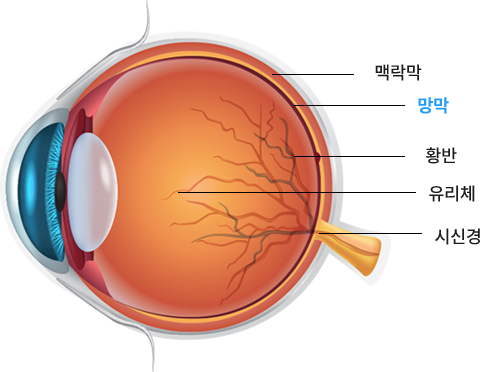 망막혈관질환