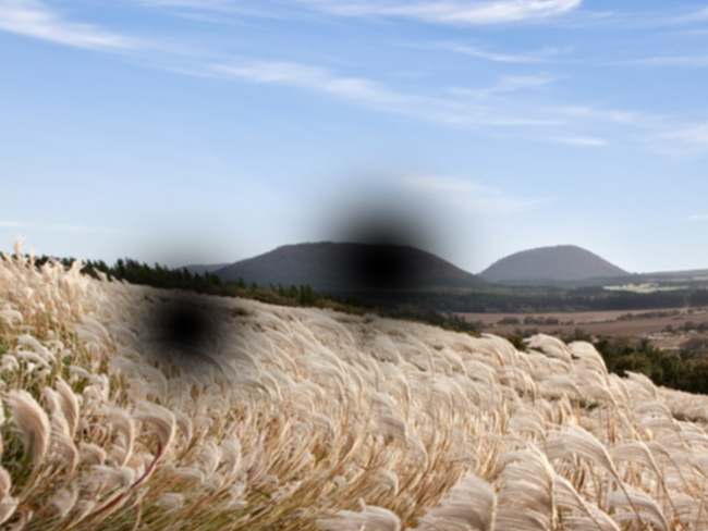 망막혈관폐쇄 시야